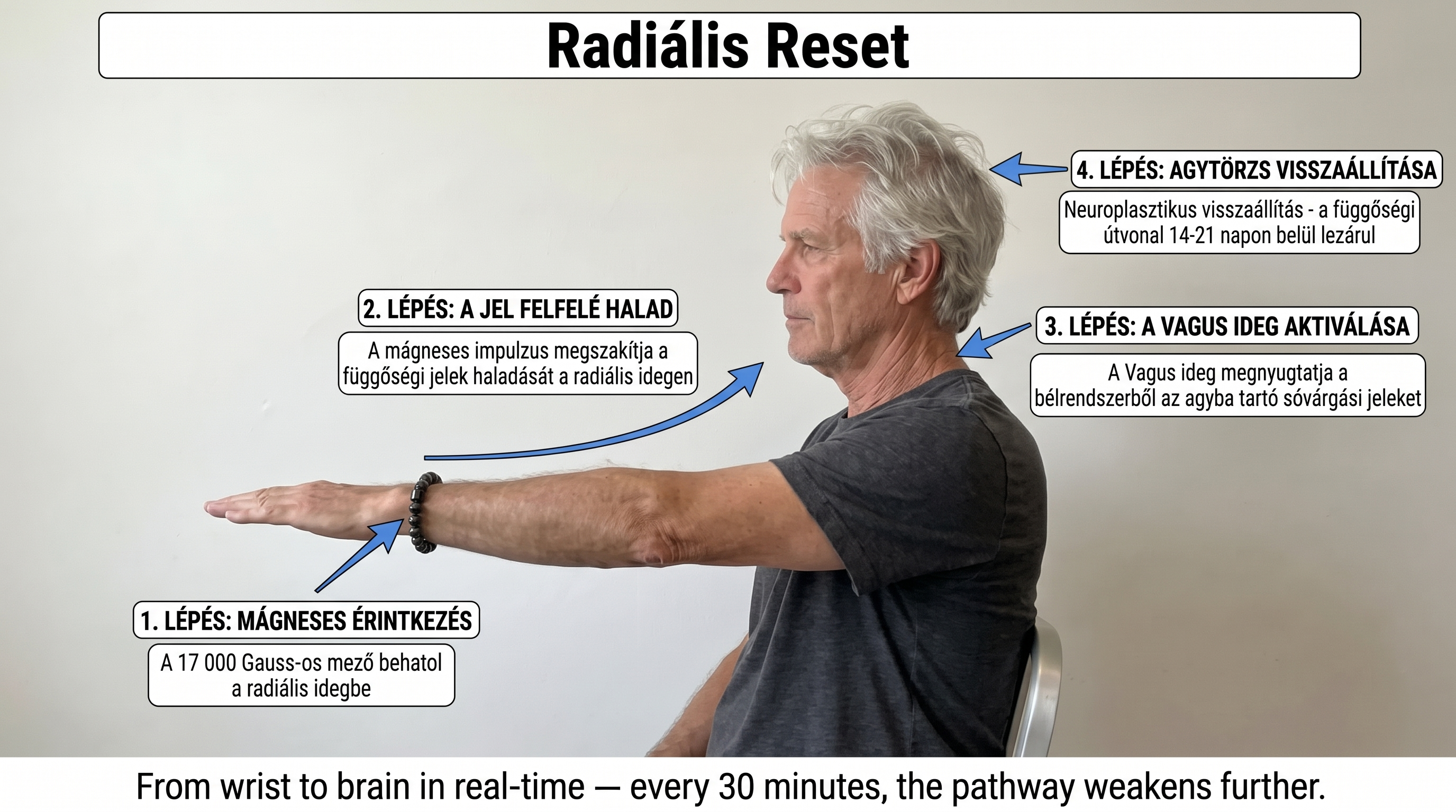 Infografika: čtyři kroky Radiálního Resetu